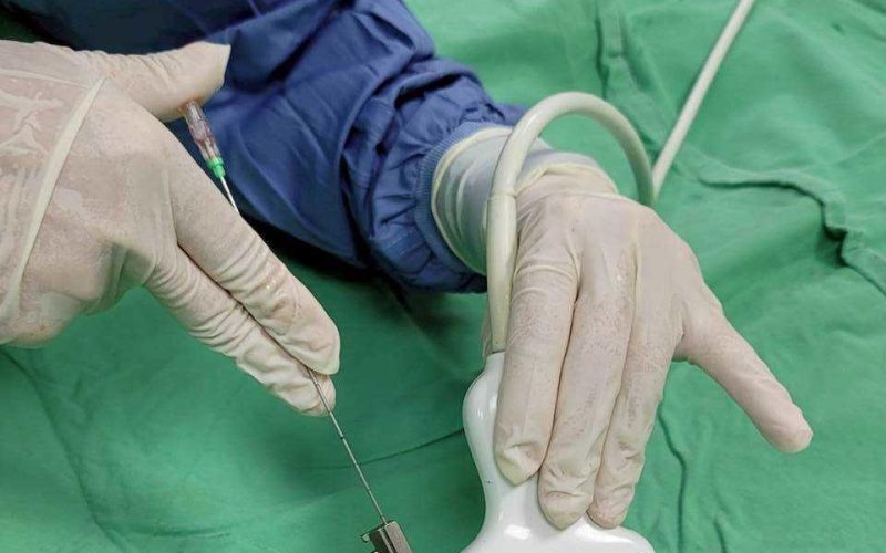 高齡長輩攝護腺肥大併發大出血　民生醫院泌尿科團隊緊急手術助轉危為安1